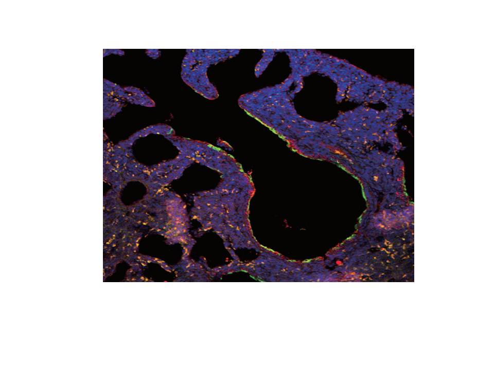 Lung-derived SSEA-1(+) stem/progenitor cells inhibit allergic airway inflammation in mice